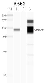 PAF49 Antibody in Immunoprecipitation (IP)