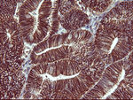 CD44 Antibody in Immunohistochemistry (Paraffin) (IHC (P))