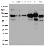 CD44 Antibody in Western Blot (WB)