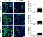 CD45 Antibody in Immunohistochemistry (IHC)