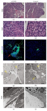 CD45 Antibody in Immunohistochemistry (Paraffin) (IHC (P))