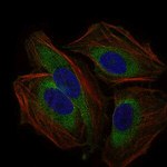 CD59 Antibody in Immunocytochemistry (ICC/IF)