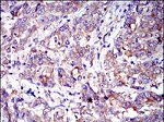 CD6 Antibody in Immunohistochemistry (Paraffin) (IHC (P))