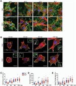 CD61 (Integrin beta 3) Antibody in Immunocytochemistry (ICC/IF)