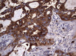 CD63 Antibody in Immunohistochemistry (Paraffin) (IHC (P))