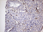 CD63 Antibody in Immunohistochemistry (Paraffin) (IHC (P))