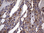 CD63 Antibody in Immunohistochemistry (Paraffin) (IHC (P))