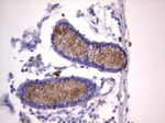 CD63 Antibody in Immunohistochemistry (Paraffin) (IHC (P))