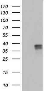 CD63 Antibody in Western Blot (WB)