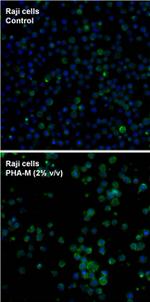 CD69 Antibody in Immunocytochemistry (ICC/IF)