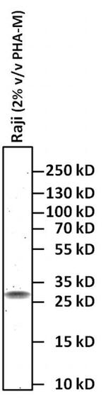 CD69 Antibody in Western Blot (WB)