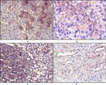 CD73 Antibody in Immunohistochemistry (Paraffin) (IHC (P))