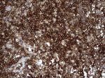 CD99 Antibody in Immunohistochemistry (Paraffin) (IHC (P))