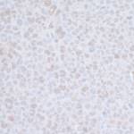 CDC20 Antibody in Immunohistochemistry (IHC)