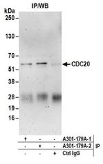 CDC20 Antibody in Immunoprecipitation (IP)