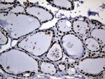 CDC45 Antibody in Immunohistochemistry (Paraffin) (IHC (P))