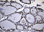 CDC45 Antibody in Immunohistochemistry (Paraffin) (IHC (P))