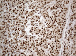 CDC45 Antibody in Immunohistochemistry (Paraffin) (IHC (P))