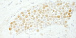 CDC5L Antibody in Immunohistochemistry (IHC)