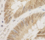 CDC6 Antibody in Immunohistochemistry (IHC)