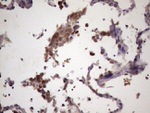 CDC6 Antibody in Immunohistochemistry (Paraffin) (IHC (P))