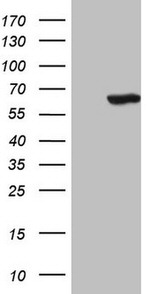 CDC6 Antibody in Western Blot (WB)