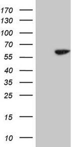 CDC6 Antibody in Western Blot (WB)