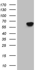 CDC6 Antibody in Western Blot (WB)