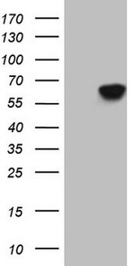 CDC6 Antibody in Western Blot (WB)