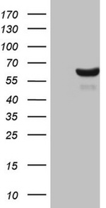 CDC6 Antibody in Western Blot (WB)