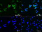 CDH1 Antibody in Immunocytochemistry (ICC/IF)