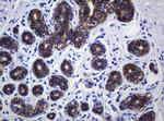 CDH1 Antibody in Immunohistochemistry (Paraffin) (IHC (P))