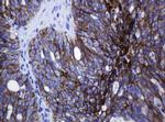 CDH1 Antibody in Immunohistochemistry (Paraffin) (IHC (P))