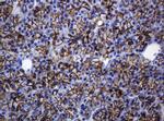 CDH1 Antibody in Immunohistochemistry (Paraffin) (IHC (P))