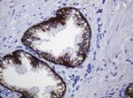 CDH1 Antibody in Immunohistochemistry (Paraffin) (IHC (P))