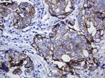 CDH1 Antibody in Immunohistochemistry (Paraffin) (IHC (P))