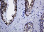 CDH1 Antibody in Immunohistochemistry (Paraffin) (IHC (P))