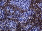 CDH1 Antibody in Immunohistochemistry (Paraffin) (IHC (P))