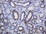 CDH1 Antibody in Immunohistochemistry (Paraffin) (IHC (P))