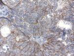 CDH1 Antibody in Immunohistochemistry (Paraffin) (IHC (P))