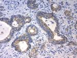 CDH1 Antibody in Immunohistochemistry (Paraffin) (IHC (P))