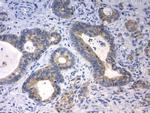 CDH1 Antibody in Immunohistochemistry (Paraffin) (IHC (P))