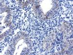 CDH1 Antibody in Immunohistochemistry (Paraffin) (IHC (P))