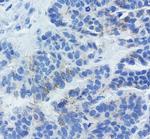 CDH1 Antibody in Immunohistochemistry (Paraffin) (IHC (P))