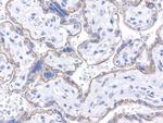 CDH1 Antibody in Immunohistochemistry (Paraffin) (IHC (P))