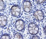 CDH1 Antibody in Immunohistochemistry (Paraffin) (IHC (P))