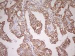 CDH1 Antibody in Immunohistochemistry (Paraffin) (IHC (P))