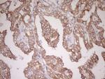 CDH1 Antibody in Immunohistochemistry (Paraffin) (IHC (P))