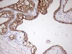 CDH1 Antibody in Immunohistochemistry (Paraffin) (IHC (P))