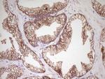 CDH1 Antibody in Immunohistochemistry (Paraffin) (IHC (P))